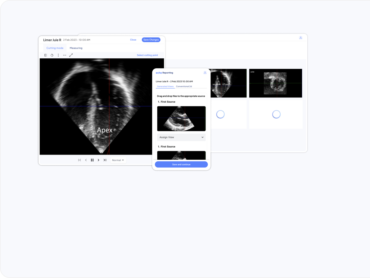 Enhance Your Reporting with AI-Powered Insights: Introducing MedEye.AI -  USYTech